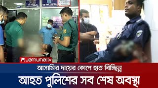 আসামির দায়ের কোপে হাত হারানো সেই পুলিশ কেমন আছেন? | Police Injured