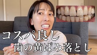 【歯科衛生士】コスパ重視で黄ばみを落としたいならコレだ‼️