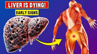 Shocking! 17 Signs that Your LIVER is DYING - You Must Know!