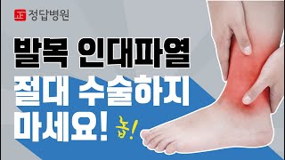 발목인대파열, 수술없이 낫는 방법 수원정형외과