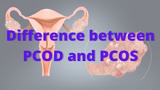 Difference between PCOD and PCOS | PolyCystic Ovarian Syndrom and PolyCystic Ovarian Disease |