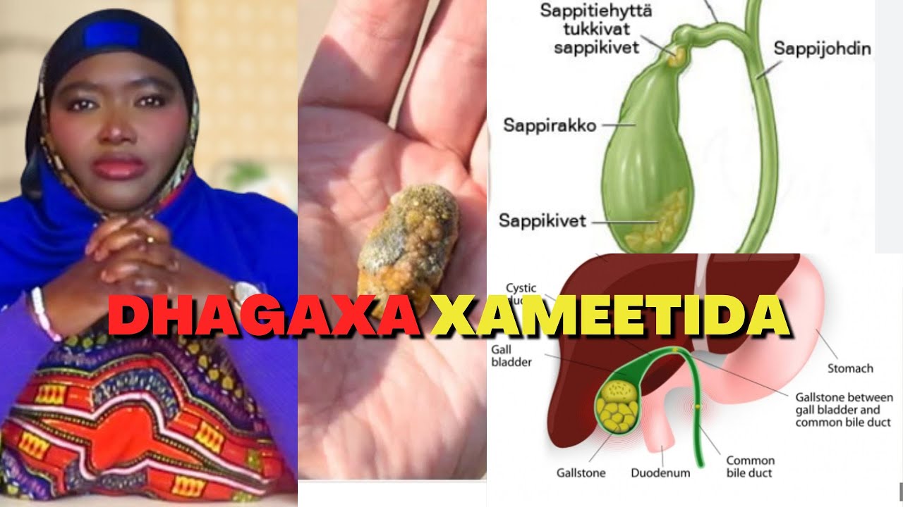 SABABAHA KEENA DHAGAXA XAMEETIDA IYO ASTAAMAHA LAGU GARTO! - YouTube