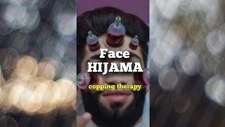Face Cupping Therapy | Hijama #shorts #hijama