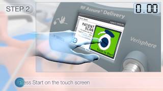 RF Assure Delivery System