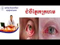 ជំងឺក្រហមភ្នែក pink eyes វេជ្ជ. ណាំ សុខណាង dr.nam soknang