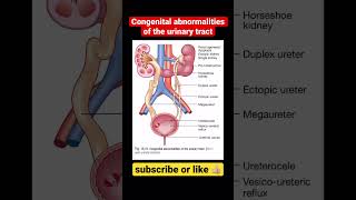 Congenital abnormalities of the urinary tract