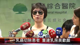 20160805 乳癌切除患者 重建乳房展歡顏