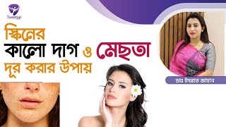 ত্বকের কালো দাগ ও মেছতা দূর করার কার্যকরী  উপায় | Solution of Dark Spots and Blemishes