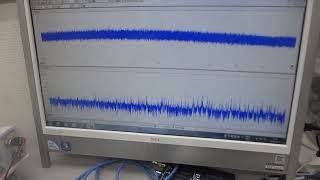 超音波素子表面の表面弾性波利用技術（超音波システム研究所）