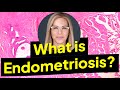 Endometriosis Symptoms and Endometriosis Treatment w/ Susan Winograd PT