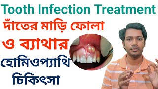 Tooth infection treatment| মাড়ি ফোলা কমানোর উপায়|Homeopathic treatment|