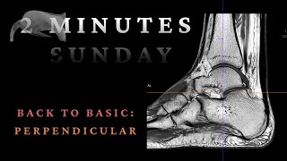 BACK TO BASIC - PERPENDICULAR #MRI