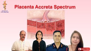 Placenta Accreta Spectrum