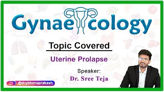 Uterine prolapse - Gyneacology - A live streaming discussion