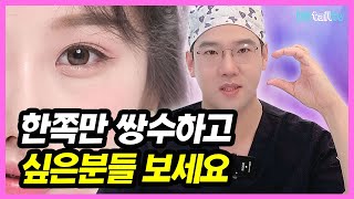 한쪽눈성형, 한쪽만 쌍수하고 싶은분들 보세요!~