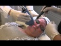 Fraxel Laser | MI-Skin Dermatology Center