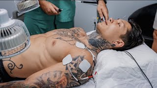 I Tried Acupuncture For The First Time With Brandon William