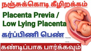 Nanji kodi Kezhirakkam(Full Explanation) || Low Lying Placenta || Placenta Previa || Pregnancy Tips