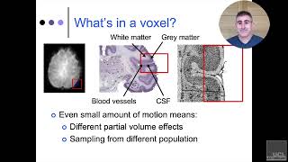12. Preprocessing fMRI Data: Realignment and interpolation