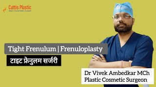 Tight Frenulum |Short Frenulum Frenuloplasty | Circumcision Khatna Phimosis Khatna Video Rewa Satna