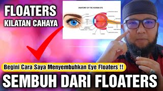 Eye FLoaters Saya sembuh Lalu Muncul Kilatan Cahaya Dimata !! Pertanda Apakah Ini ???