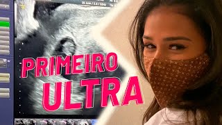 PRIMEIRO ULTRASSOM DO BEBÊ