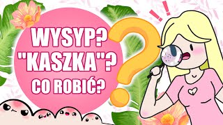 Wysyp? Kaszka? Co robić? (+ Propozycje kosmetyków!)