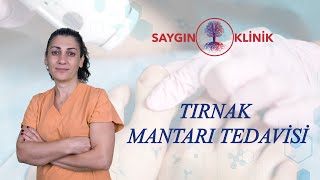 Tırnak Mantarı Ve Tedavisi