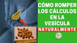 remedios caseros para expulsar las piedras de la vesicula
