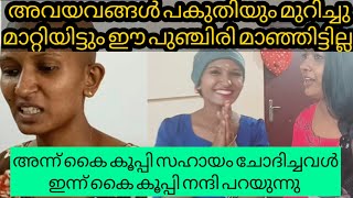 നിങ്ങൾ കാരണം മാത്രം ആണ് ഇന്ന് ഇവൾ ജീവിച്ചിരിക്കുന്നത് 🙏 #villagelifediary #vlog