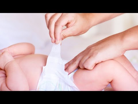 Neocare Premium Belt System Baby Diaper (7-18 kg) (30 Pcs)