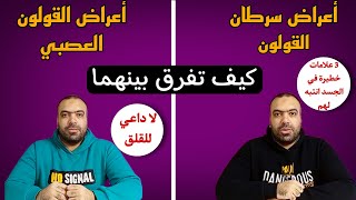 تعرف على الفرق بين أعراض سرطان القولون و القولون العصبي بطريقة سهلة في المنزل