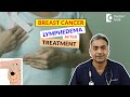 Swollen Arms after Breast Cancer Treatment | Lymphedema Treatment - Dr. Srikanth V | Doctors' Circle