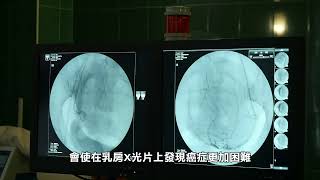 【健康快訊】乳房X光報告必須包含乳腺密度評估 Breast X-ray reports must include breast density assessment