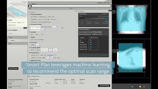 Effortless Workflow Clarity UI Auto Prescription and Smart Plan