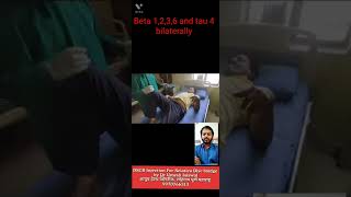 DSCB for Disc Buldge Patient Sciatica by Dr Umesh Jaiswal Aayush Health clinic Pune 9970766313