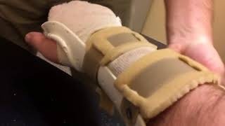 Recovering from Guillain Barré: Making The Super Splint