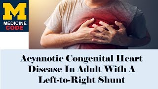 Acyanotic Congenital Heart Disease In Adult With A Left-to-Right Shunt