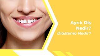 Ayrık Diş Nedir? Diastema nedir?