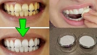 सिर्फ 1 मिनट में दांतो का पीलापन दूर करके पाएं मोती जैसे चमकदार दांत | Teeth Whitening Tips In Hindi