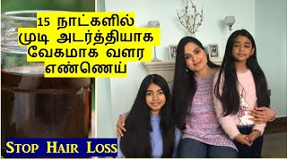 Grow Long \u0026 Thick Hair in 15 Days / Homemade Herbal Hair Oil/ Chennai Girl In London