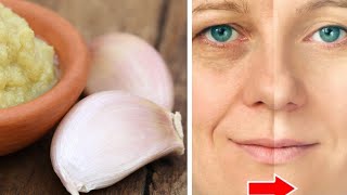 Knoblauch und Zwiebeln sind millionenfach stärker als Botox: Sie beseitigen Falten sofort!