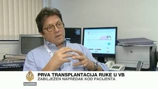 Prva transplantacija ruke u Velikoj Britaniji - Al Jazeera Balkans