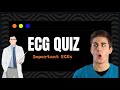 ECG QUIZ