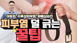 📌아토피 지루성피부염 덜 긁는 꿀팁 공개합니다. 묶고 자면 덜 긁어요