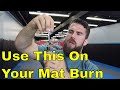 Got Mat Burn on Your Toes from BJJ? (Try This Instead of Tape)