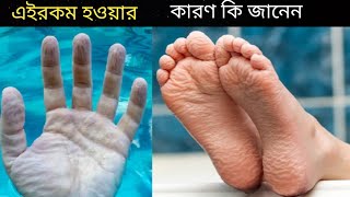 পানিতে দীর্ঘসময় হাত ভিজিয়ে রাখলে হাতের চামড়া কুঁচকে যায় কেন |