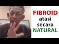 FIBROID, Cara terbaik atasi secara NATURAL | Dr. Noordin Darus