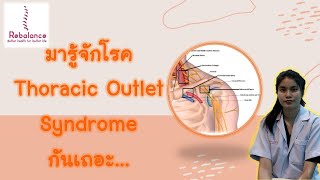 Thoracic Outlet Syndrome อาการเป็นอย่างไร บริหารร่างกายอย่างไร มาดูกัน