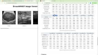 Building an End-to-End BreastMNIST Classification Pipeline with CNN \u0026 ResNet18